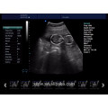 Trolley vascular doppler & color doppler ultrasound price DW-C80